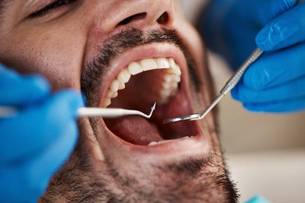 Best Emergency Dental Care for Trauma or Injury in Bridgewater Center, NJ